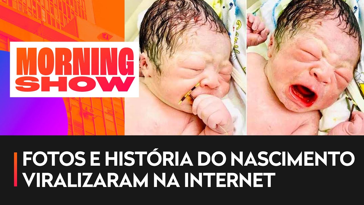 Bebê nasce com DIU na mão e chama atenção nas redes sociais